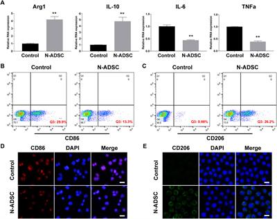 Adhesive hydrogel wrap loaded with Netrin-1-modified adipose-derived stem cells: An effective approach against periarterial inflammation after endovascular intervention